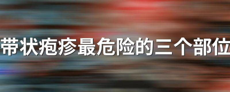 带状疱疹最危险的三个部位 带状疱疹可以洗澡吗